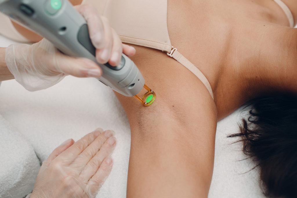 Laserbehandling for å fjerne hår i armhulen til en kvinne.